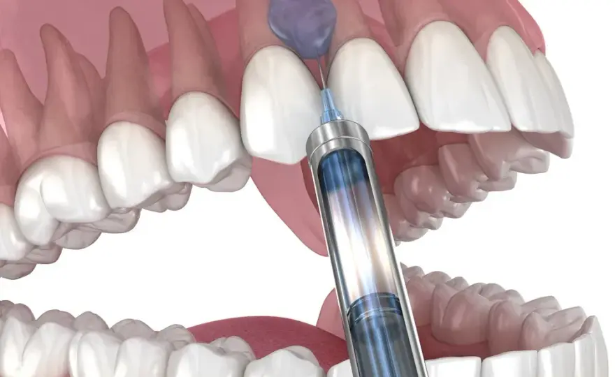 Jak długo działa znieczulenie u dentysty? Sprawdź, kiedy wróci czucie!