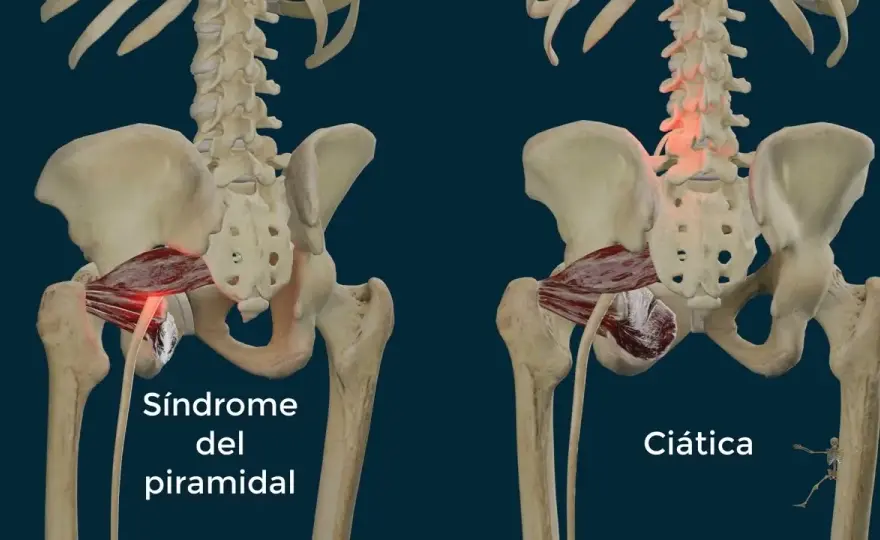 Músculos piramidales: diferencias clave entre piriforme y piramidal
