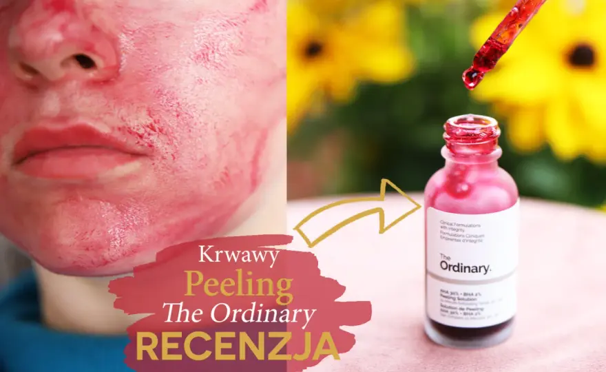 Czerwony peeling The Ordinary - Jak stosować bezpiecznie?