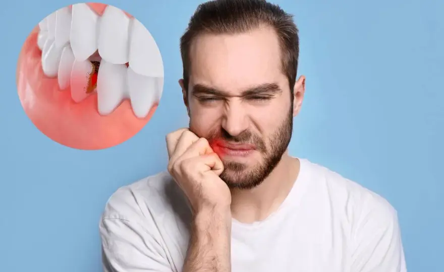 Dolore sotto capsula dentale - Quando agire subito?
