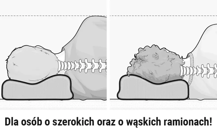 Skręcenie karku objawy: Jak rozpoznać i uniknąć bólu szyi