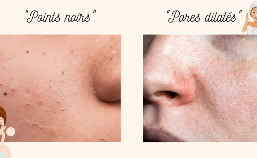 Comment rendre les pores moins visibles sans agresser la peau ?