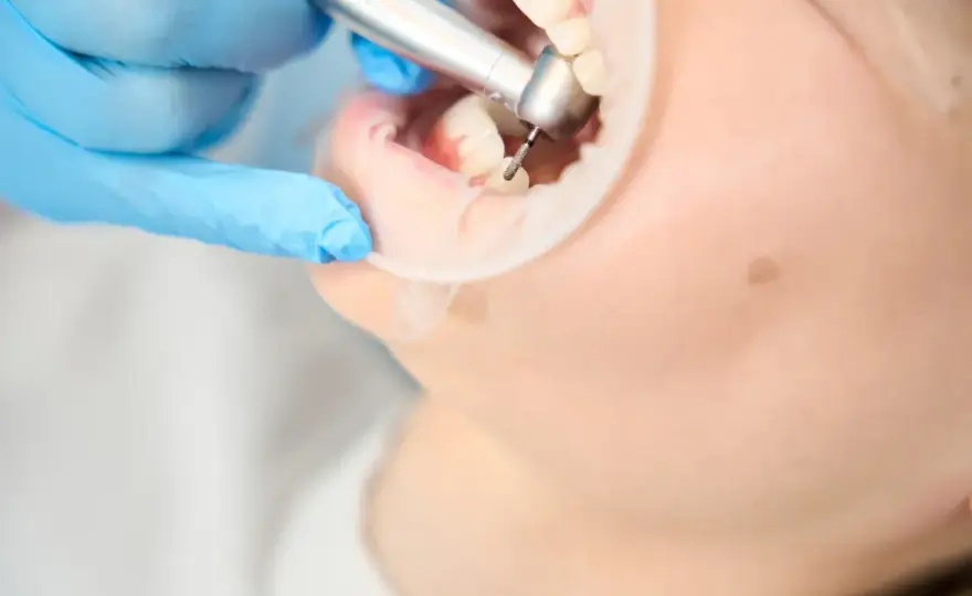 Ile trwa wizyta u dentysty? Poznaj czas trwania różnych zabiegów