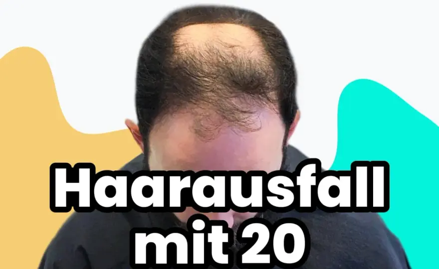 Haarausfall mit 20 - Ursachen & Lösungen für junge Männer