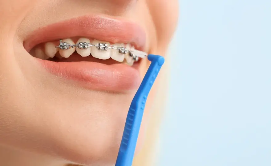 Alito cattivo - Cosa funziona davvero e quando serve il dentista
