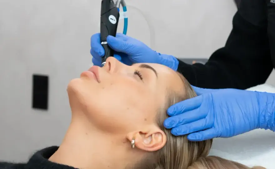 Fractional CO2 laser – Fördelar, pris & återhämtning