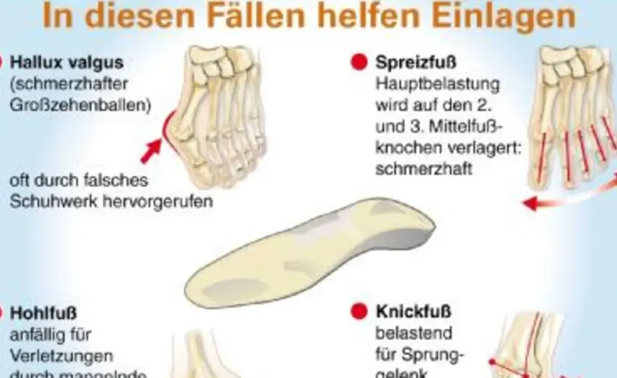 Weichpolstereinlagen - Wann sie wirklich helfen & was sie kosten