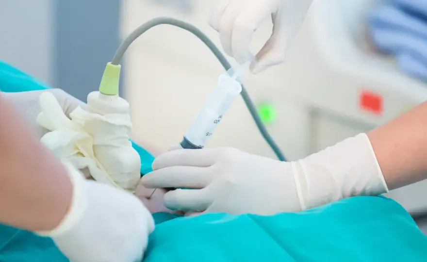 Amniocentesi da quale settimana e cosa sapere prima dell'esame