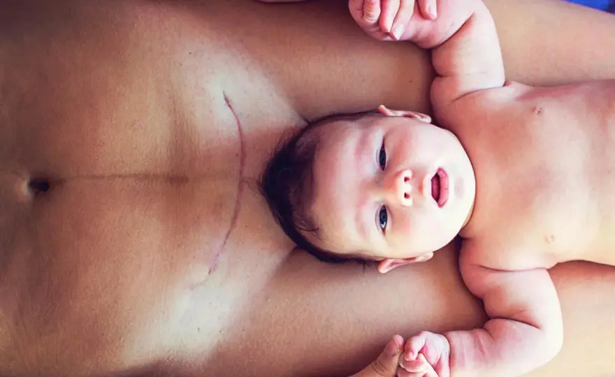 Kaiserschnitt Baby - Wann Symptome wirklich gefährlich sind