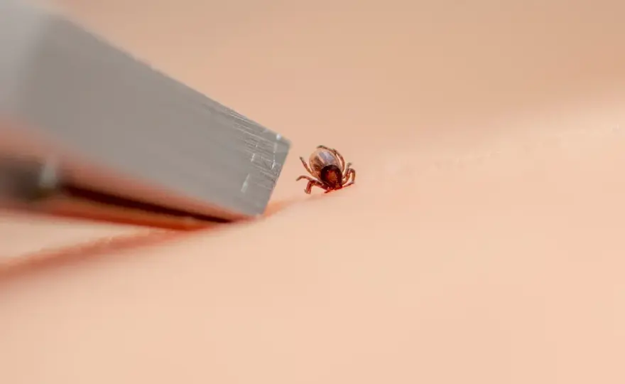 Jak bezpiecznie usunąć kleszcza u dziecka? Instrukcja krok po kroku