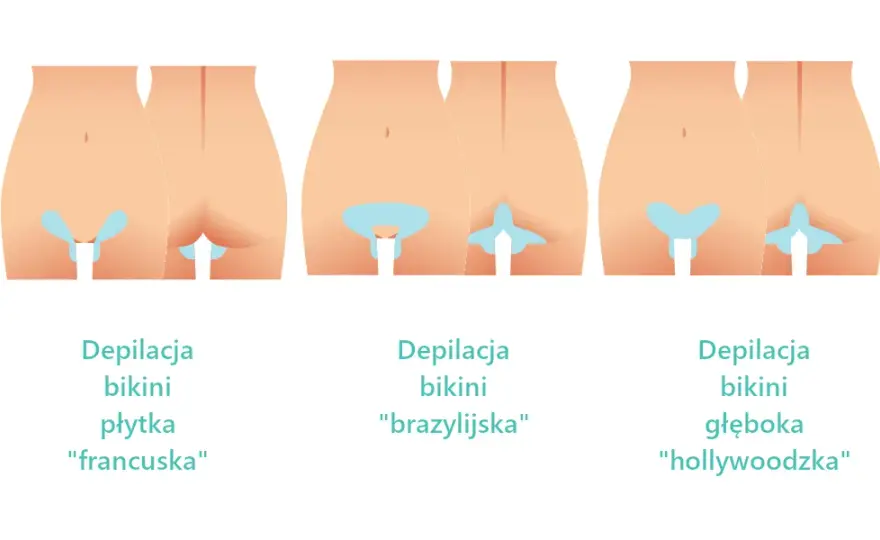 Depilacja bikini: Jak wygląda? Rodzaje, przebieg, porady ekspertki