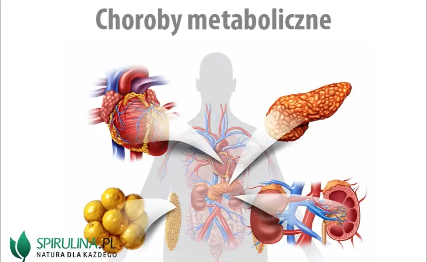 Zaburzenia metaboliczne: objawy, przyczyny i leczenie. Sprawdź, co jeść!