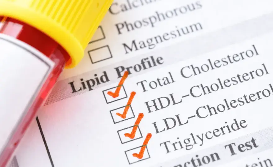 Jak się przygotować do badania cholesterolu, by uniknąć błędów?