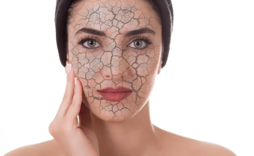 Estrés oxidativo en la piel - qué es y cómo protegerla