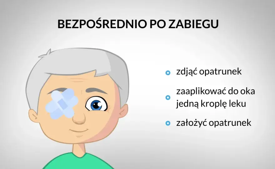 Czego nie wolno robić po operacji zaćmy? Zakazy i powrót do formy