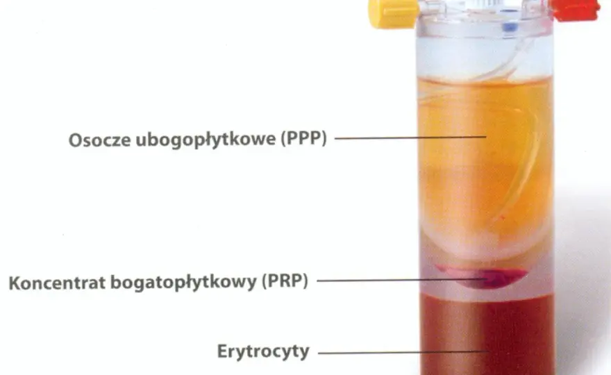 Osocze krwi - Czy wiesz, czym jest PRP i jak działa?