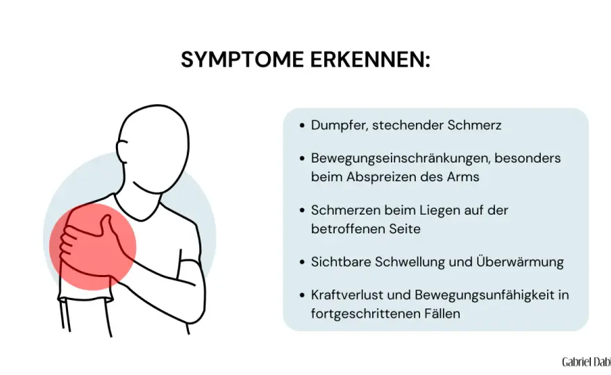 Schleimbeutelentzündung in der Schulter erkennen und richtig behandeln