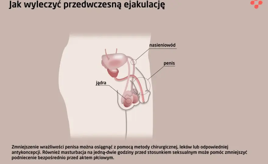 Przedwczesny wytrysk - Przyczyny, leczenie i co naprawdę działa