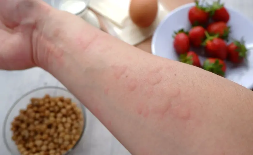 Alergia krzyżowa - Gdy pyłki gryzą w jedzeniu. Co robić?