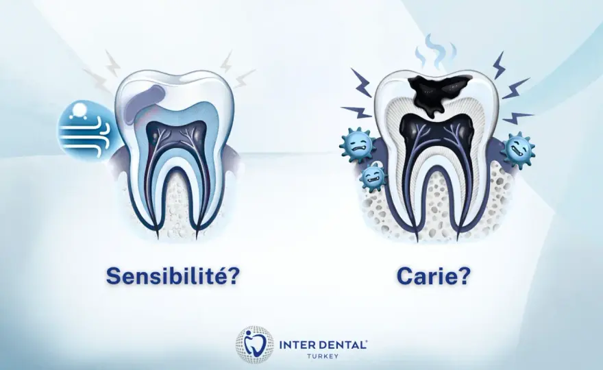 Sensibilité dentaire, que faire et quand consulter ?