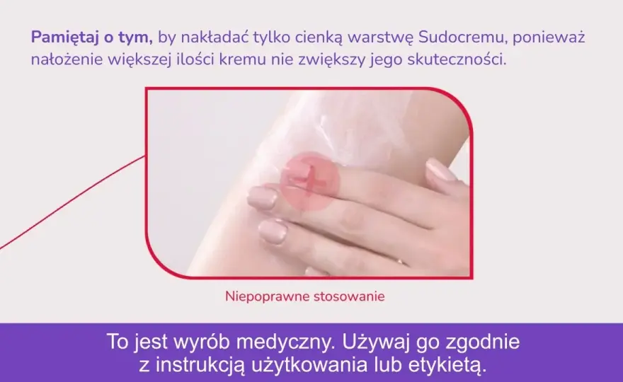 Sudocrem na pryszcze: czy warto? Opinie, skład i skuteczne alternatywy