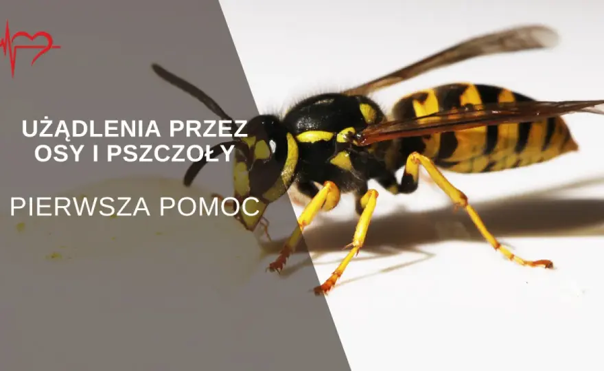 Użądlenie osy - jak reagować i kiedy wzywać pomoc?