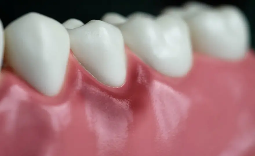 Encía roja en un diente - causas y cuándo ir al dentista