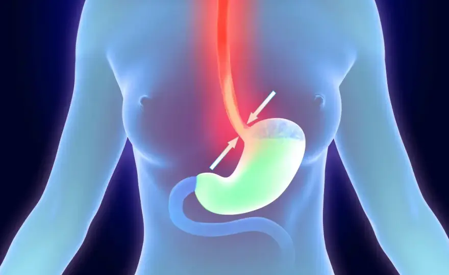 Ansia e stomaco - Nausea, gonfiore e crampi: cosa fare?