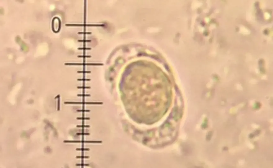 Blastocystis hominis - charakterystyka, objawy i naturalne leczenie