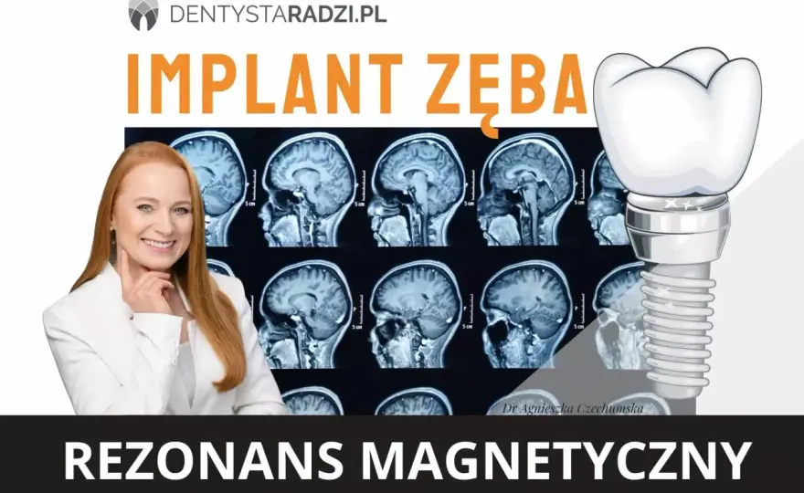 Rezonans magnetyczny a metal w zębie - Czy to problem?