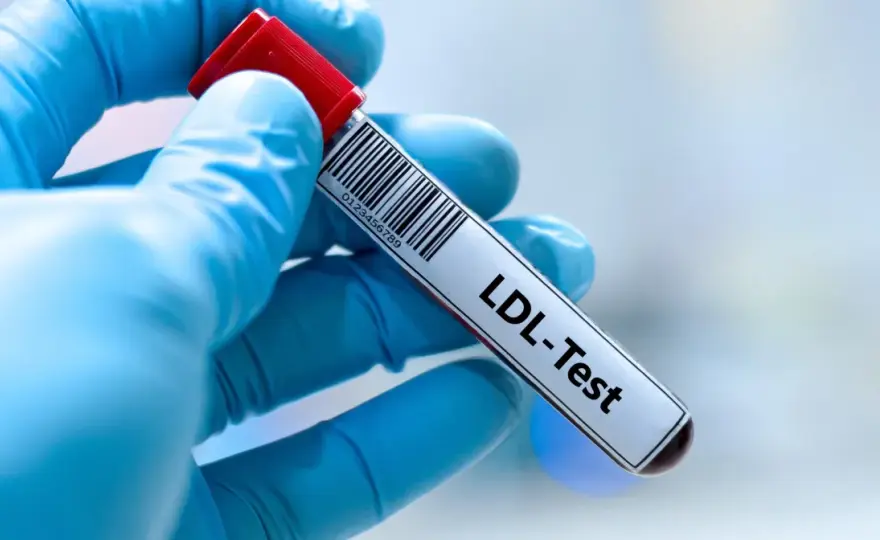 Podwyższony cholesterol LDL nie boli - Jak go skutecznie obniżyć?