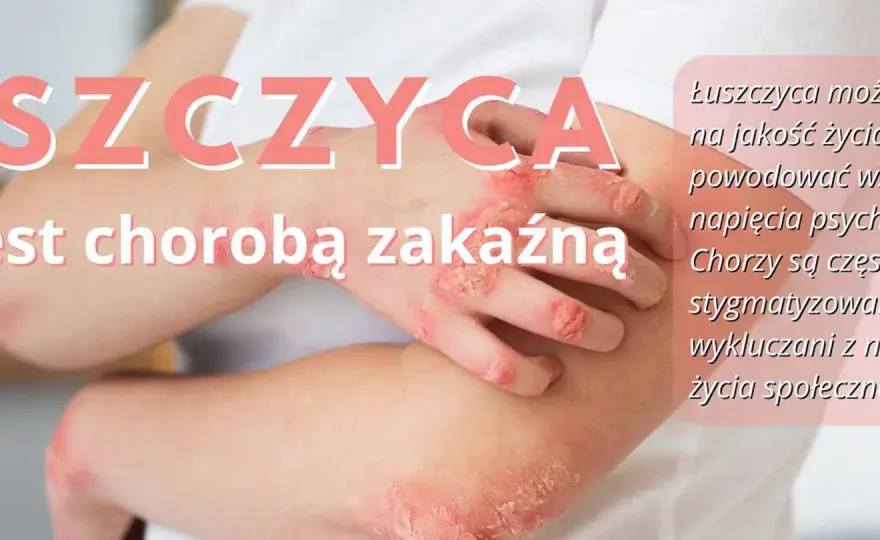 Łuszczyca - nie tylko skóra. Kompleksowy przewodnik po chorobie