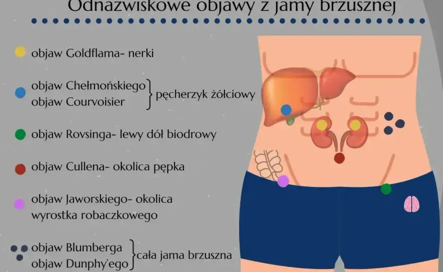 Jak boli wyrostek? Rozpoznaj objawy i działaj szybko!