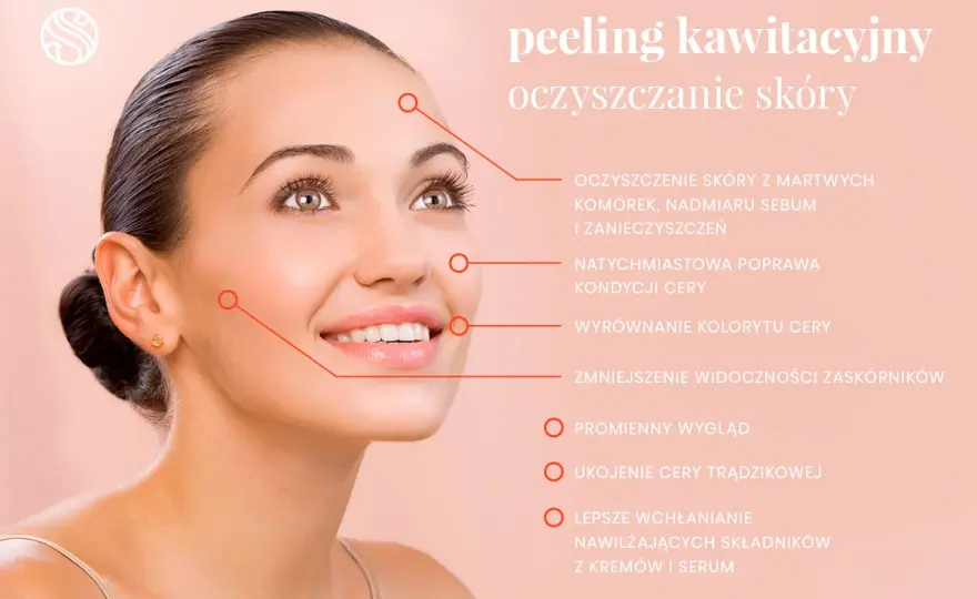 Peeling kawitacyjny - jakie efekty uboczne są normalne?