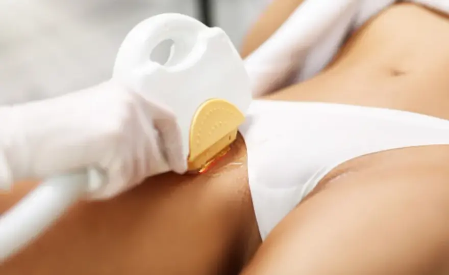Depilacja laserowa bikini czy boli? Oto co musisz wiedzieć
