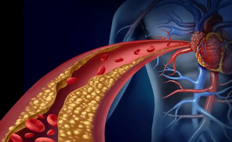 Dyslipidemia - Jak skutecznie poprawić wyniki i zadbać o serce?
