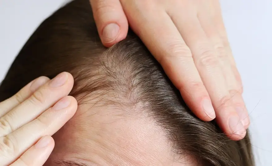 Picor del cuero cabelludo y caída del cabello - causas y señales