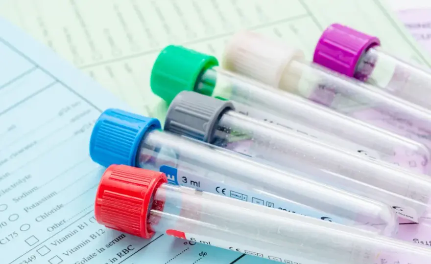 Ważność skierowania do laboratorium: Mit 30 dni? NFZ i prywatne