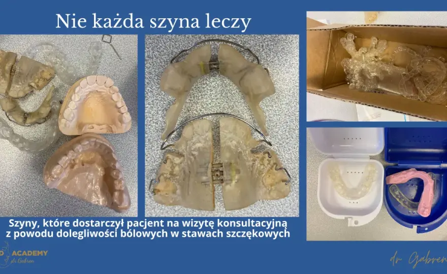 Bruksizm - kiedy aparat na zęby, a kiedy szyna relaksacyjna?