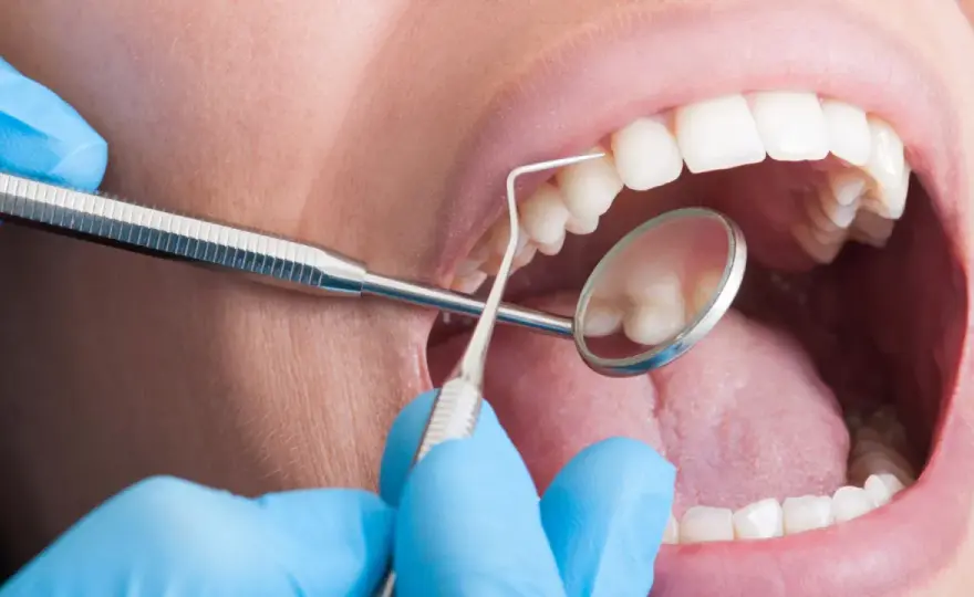 La pulizia dei denti fa male? Verità e consigli utili