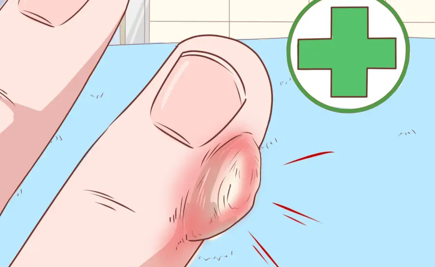 Callosité sur les mains, que faire sans abîmer la peau ?