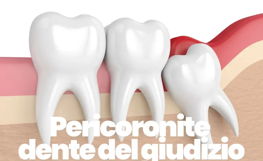 Dente che spunta dalla gengiva - Quando preoccuparsi?
