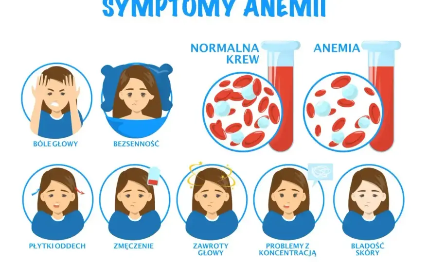 Niedobór żelaza - neurologiczne objawy, badania i leczenie