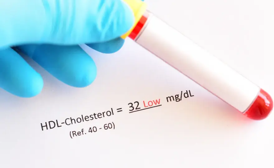 Pitamet - lek na cholesterol: jak działa i kiedy go stosować?