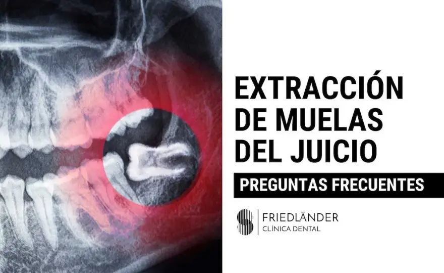 Cara después de sacar una muela del juicio - qué esperar