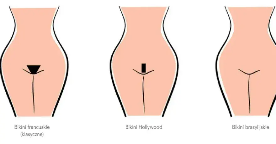 Depilacja laserowa bikini: Ile trwa? Pełny harmonogram i efekty