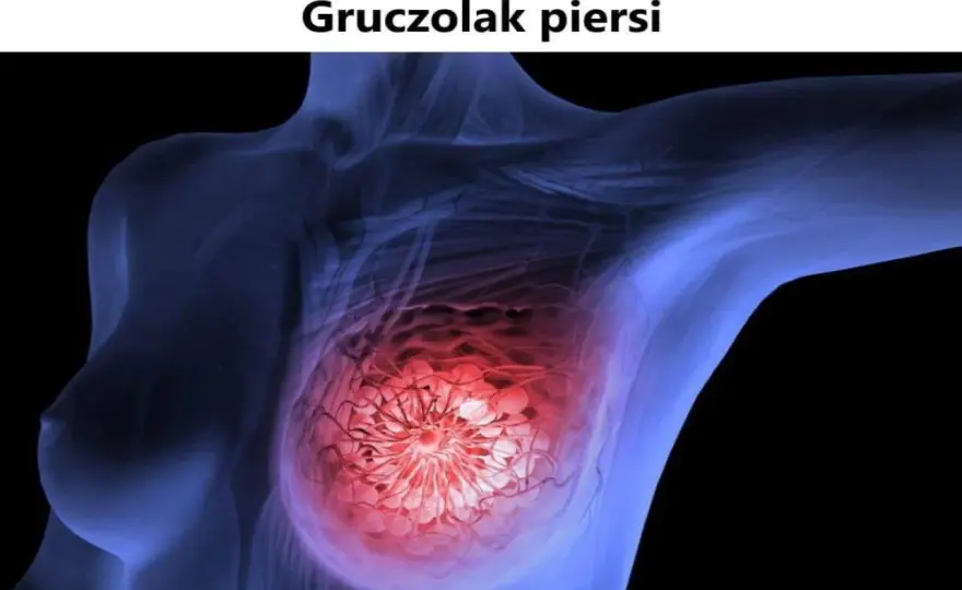 Gruczolak - łagodny, ale czy bezpieczny? Objawy, leczenie, diagnostyka