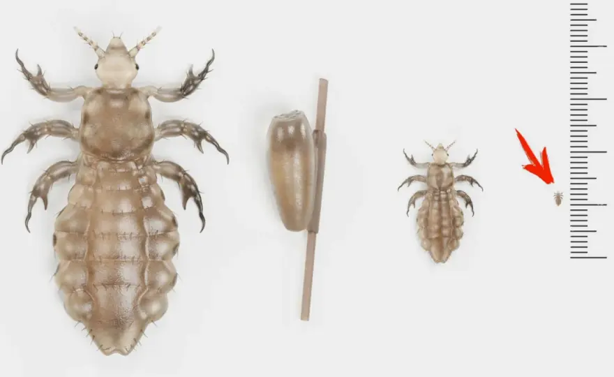 Quanto vive un pidocchio sul cuscino? Cosa fare davvero
