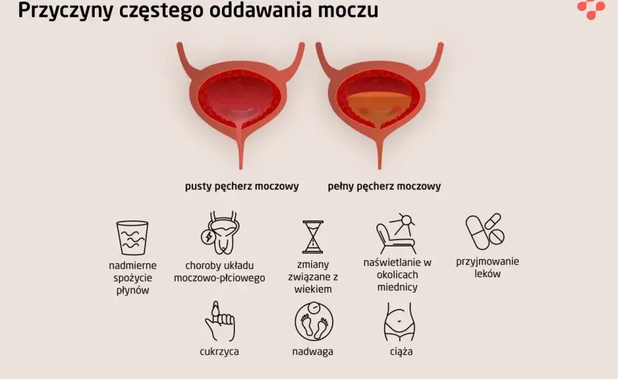 Poliuria - nadmierne oddawanie moczu. Kiedy to choroba?
