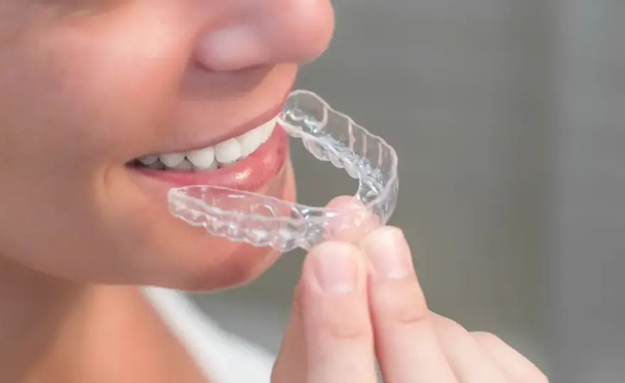 Clear aligner - Czy to rozwiązanie dla Ciebie? Sprawdź!